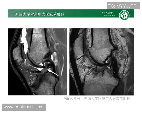 约维奇重摔受伤退场X光检查结果无异常明日将进行MRI检查评估伤情